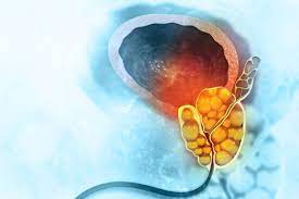 Biliary Tract